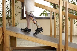 Male prosthesis wearer training to climb a slope